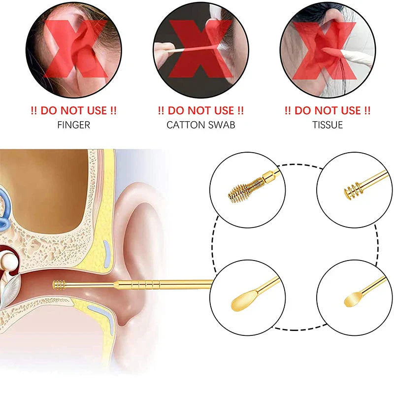Ear Wax Cleaner Tool Kit - (Buy 1 Get 1 Free)